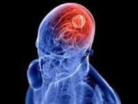 Çok televizyon izlemek beyni öldürüyor