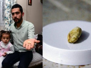 Ameliyatta sargı bezi unutuldu iddiası