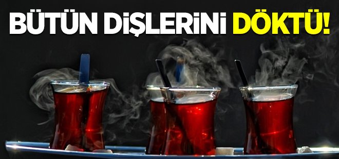 Aşırı çay bütün dişlerini döktü