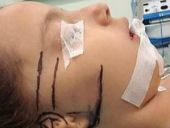 Göğüs kafesinden kulak yaptılar