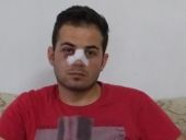 Kart gösteren hakemin burnunu kırdı