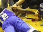 Basketbol maçında inanılmaz kaza!