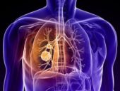 KOAH'a karşı doğal koruma yöntemleri